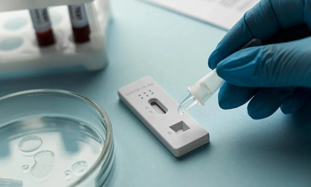 Σε ποια σημεία γίνονται δωρεάν rapid test την Παρασκευή 29 Σεπτεμβρίου